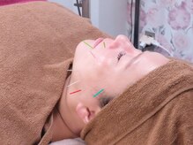 美鍼堂/ツボ刺激で顔筋のこわばりを改善