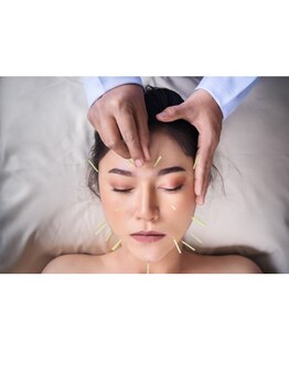 オン 蕨駅西口(ON)/美容鍼【小顔/たるみ改善】