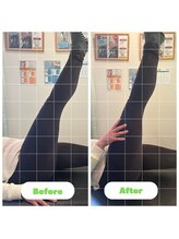 ナオル整体 長崎大村院(NAORU整体)/50代女性施術事例【骨盤矯正】