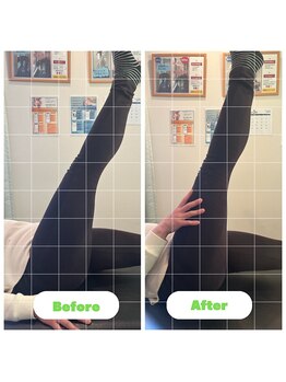 ナオル整体 長崎大村院(NAORU整体)/50代女性施術事例【骨盤矯正】