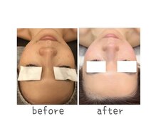 トモズサロン28(Tomos.salon.)/自分史上最高の美肌に！