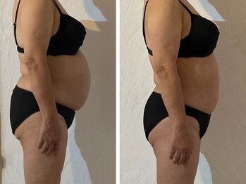 アフェ(afe)/施術