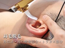 ビクトリー(VICTORY)/耳毛脱毛