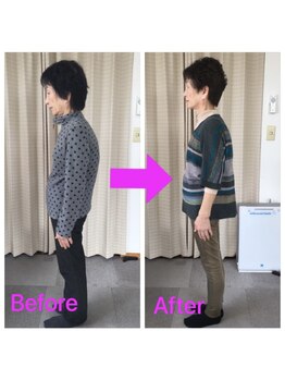 てんゆう整体/背中の丸みが改善