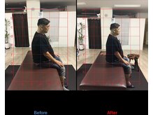 ストレチックス 近江八幡店/腰痛改善ビフォーアフター