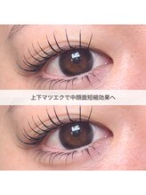 アンノウン 神戸元町店(Unknown.)/中顔面短縮/上下マツエク