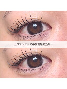 アンノウン 神戸元町店(Unknown.)/中顔面短縮/上下マツエク