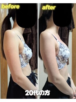 スノードロップ(snowdrop)/バストケア[１回でのバストUP]