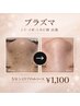 【5分シミケアのみ】気になるシミをピンポイントで！！ &nbsp;&nbsp;★￥1,100