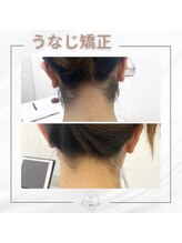 ミース 久留米店/うなじ脱毛体験1回目！