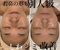 トータルエステティック ジョワイユ(JOYEUX)