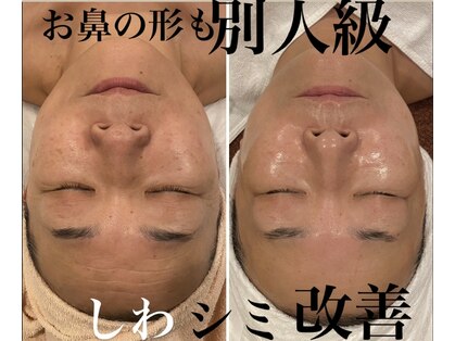 トータルエステティック ジョワイユ(JOYEUX)の写真