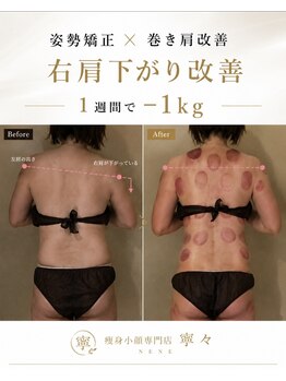 寧々/右肩の調整でマイナス1kg