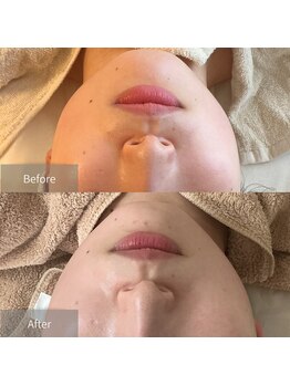 サロン ド ビビ(salon de bibi*)の写真/左右差もお任せ下さい!オーダーメイド施術だから叶う!お悩みに合わせた施術で毎回ベストな結果へ。