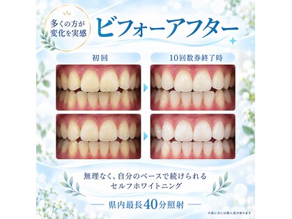 ホワイトニングショップ 甲府店の写真