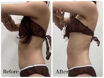 ルピア(L'pur)/上半身痩身！