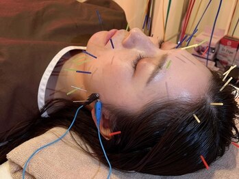 茶ノ木鍼灸整骨院/美容鍼 美肌トリートメント