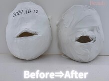 カレンジェビューティー(CarengeBeauty)/小顔矯正コルギ