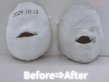 カレンジェビューティー(CarengeBeauty)/小顔矯正コルギ