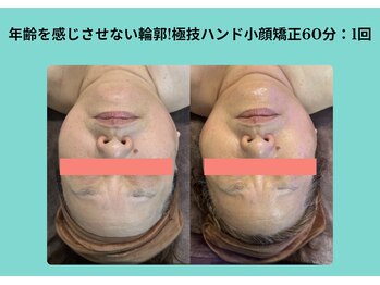 サロンビオーナ(SALON Biona)/極技ハンド小顔矯正