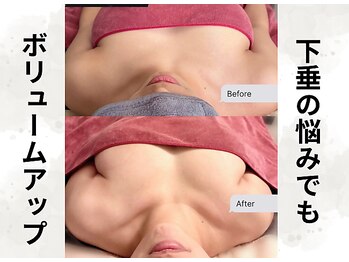 ボニービューティー(Bony Beauty)/BeforeAfter【1】