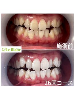 ルブラン 奈良店(Le Blanc)/本日、結婚式(^ ^)