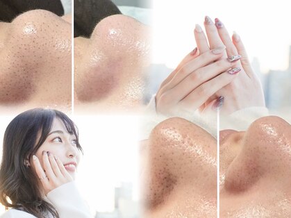 トータルビューティ ノイド(Noid)の写真
