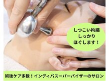 インディバ ミマリ(INDIBA ミマリ)