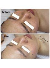 ルマエクレ(rmaecla)/直前ケアでも大丈夫