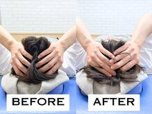 ビハリスト 新宿南口/頭のサイズからしっかり小顔に♪