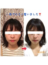 顔凛(カオリン)/20代/初回からも変化する小顔