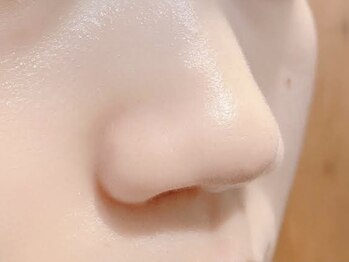 スイッチプラス(switch+)の写真/毛穴・黒ずみケアに◎話題のイノスピキュール配合ピーリングで憧れの陶器肌へ☆肌を育てる新感覚の本格ケア