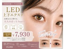ミナリス(MinaLis)