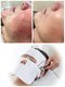 ビエル(Bielle)の写真/朝起きた瞬間、鏡を見るのが怖い《皮膚科提携》赤み不安定肌、気になる跡の根本改善フェイシャル