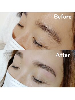 マツ(MATSU)/ハリウッドブロウリフト