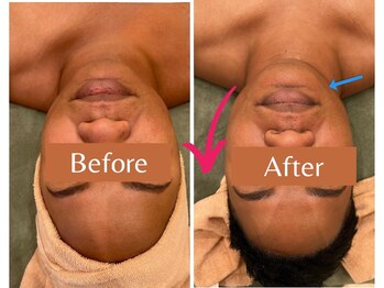 ワイズ 沖縄うるま院(Medical Y's)/脂肪燃焼小顔リフト