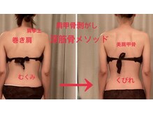 ミオ(mio)/ビフォーアフター