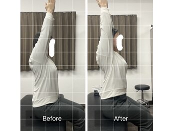 ナオル整体 平塚院(NAORU整体)/猫背矯正で肩の可動域UP!!