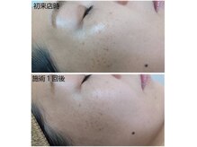 ハクア(HAQUA)の雰囲気（低価格＆都度払いで通いやすさ/効果抜群◎シミに徹底アプローチ!）