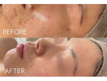 ラポール 野並店(Rapport)/