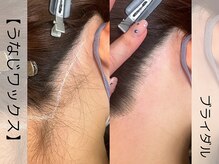 ウイ ネイルアンドビューティー(u'i nail&beauty)/首長・小顔効果　あり☆