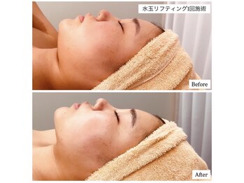 ブライトプラス 姫路店(Bright plus)/水玉リフティング