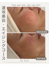 ラシュール(la sur)/