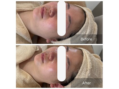 ラウレア(Laule'A)の写真