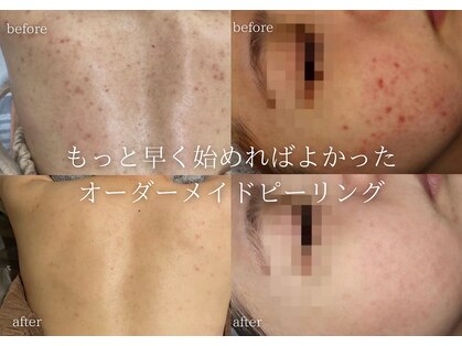 リアルナ(REALUNA)の写真
