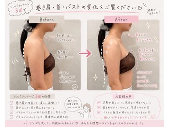 エム(eM.)/リンパマッサージ　上半身のみ