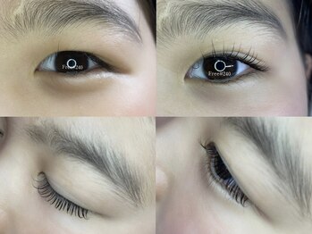 フリー#240(Free#240)/デザインラッシュリフト