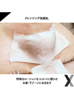 クロス(Xcross)/毛穴ケア【毛穴/代官山/渋谷】