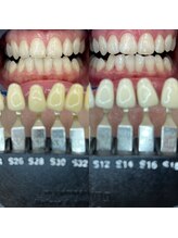 トウキョウスワーズ 池袋店(TOKYO SWRS)/#ホワイトニング #池袋 #渋谷