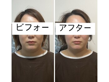 リモド(Rimodo509)/小顔矯正(ヘッドスパ
